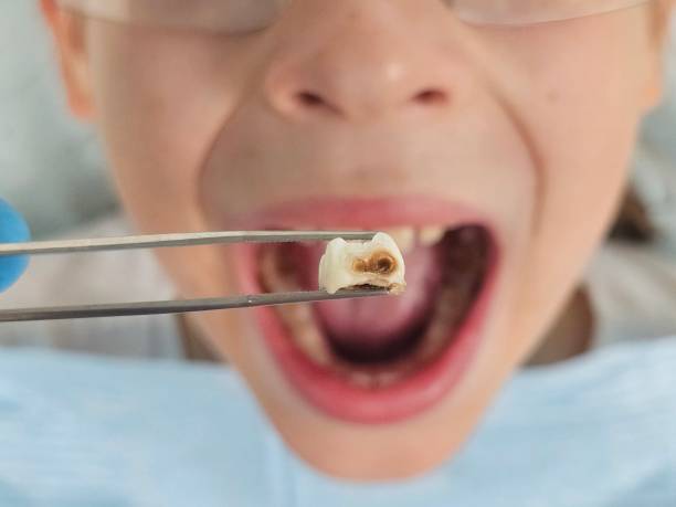 Best Emergency Gum Treatment in Lake Tapps, WA