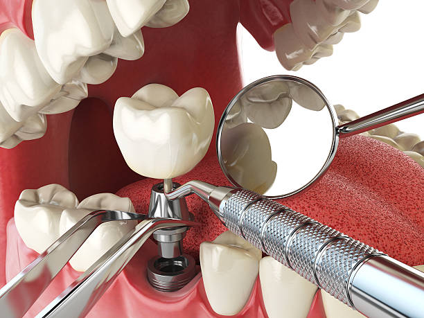 Best Emergency TMJ Treatment in Lake Tapps, WA